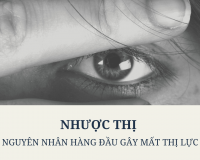 NHƯỢC THỊ: NGUYÊN NHÂN HÀNG ĐẦU GÂY MẤT THỊ LỰ